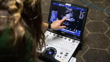 Pregnant okapi ultrasound at London Zoo