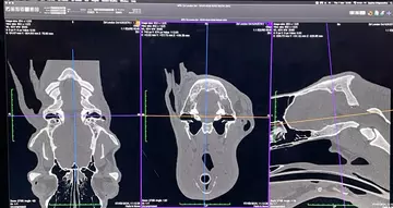 Okapi CT Scan