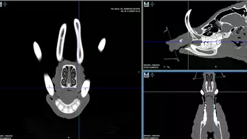 Black and white images showing results of a CT scan