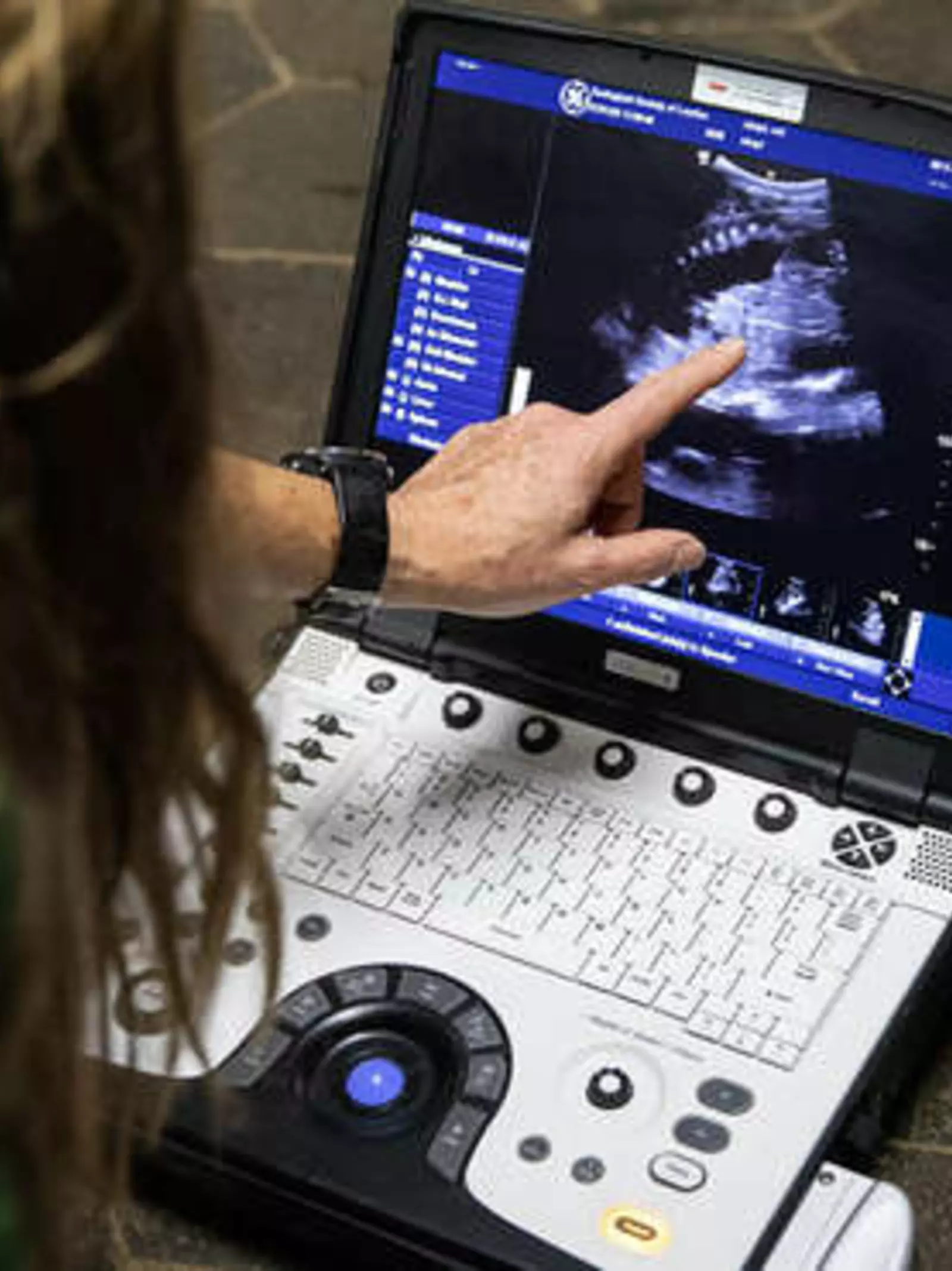 Pregnant okapi ultrasound at London Zoo